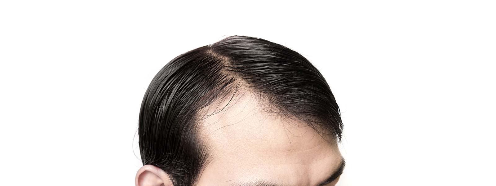 rapianto capelli piven