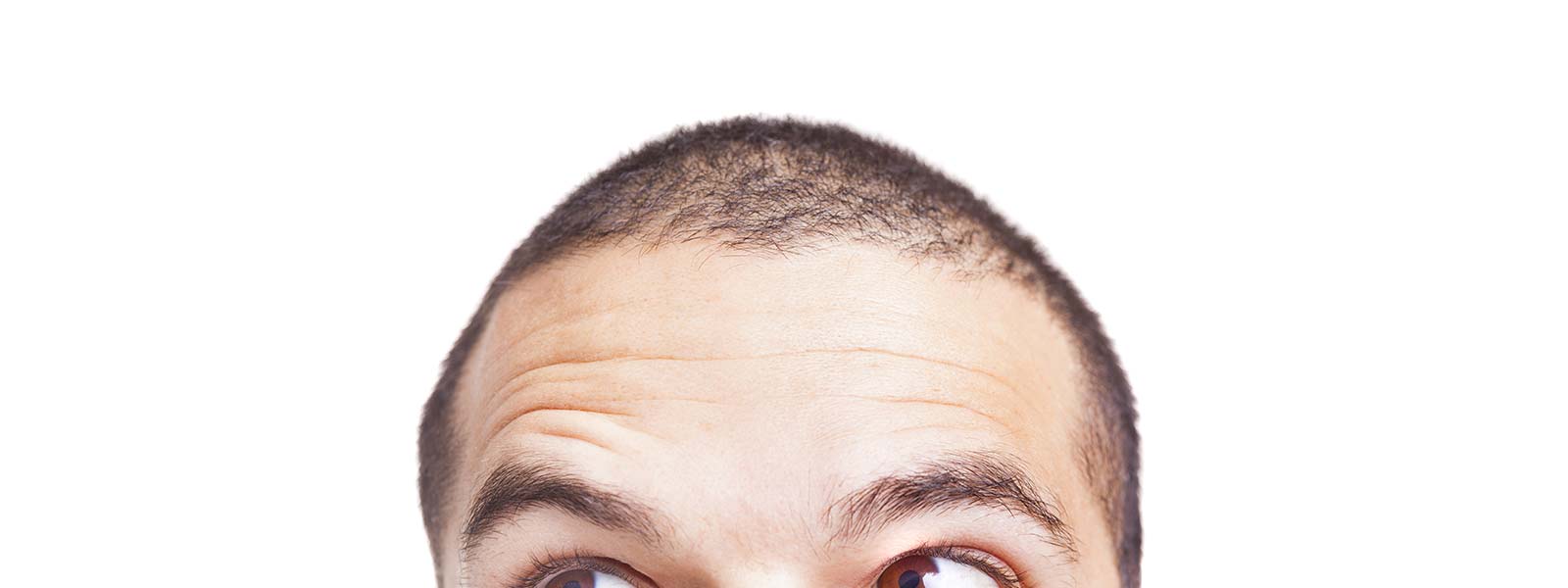 calvizie edward norton