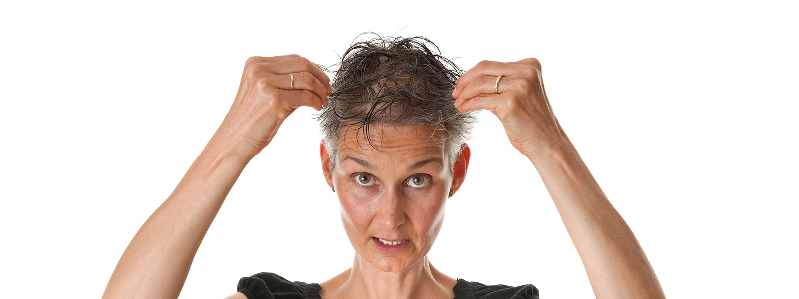 caduta capelli donna