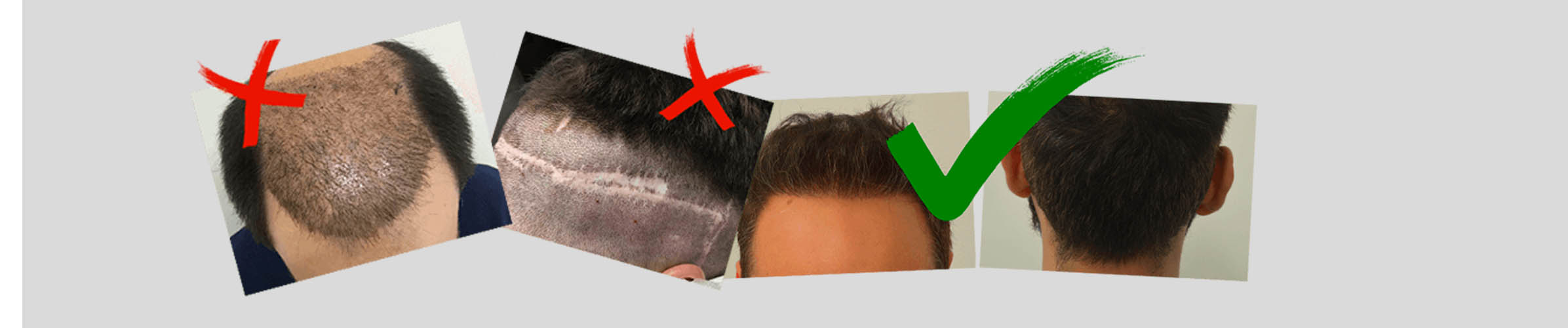 mercato nero trapainti