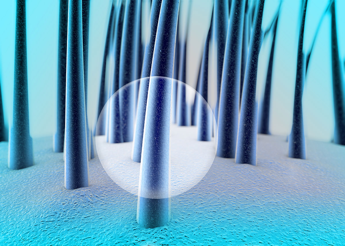 seborrea dei capelli