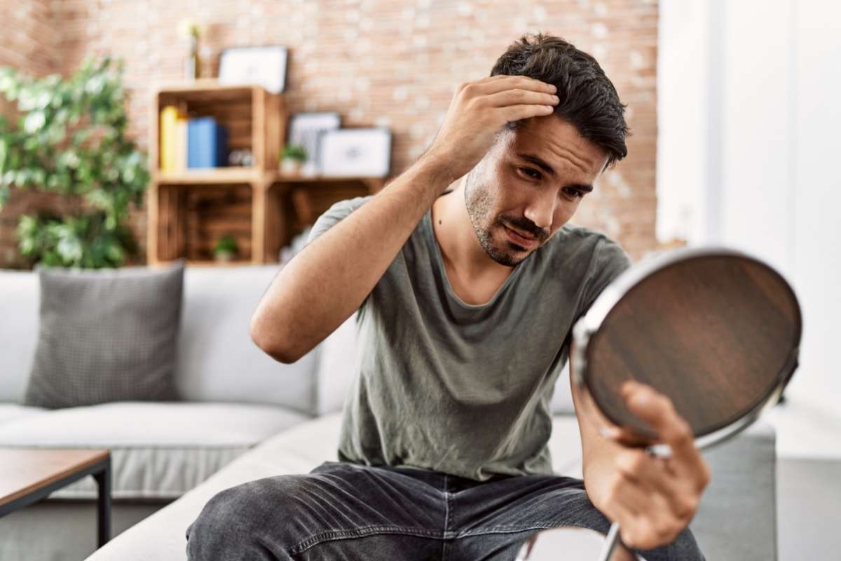 caduta capelli da giovani