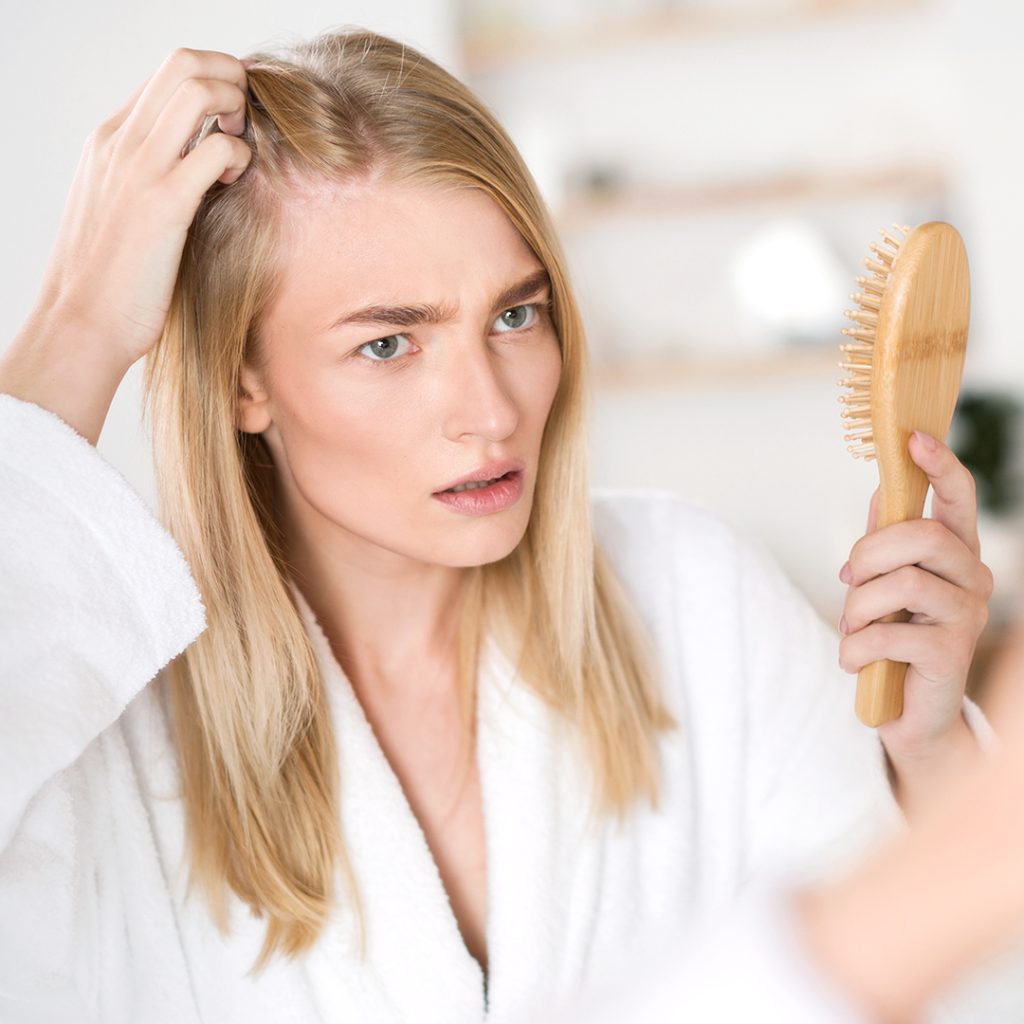 Alopecia androgenetica femminile