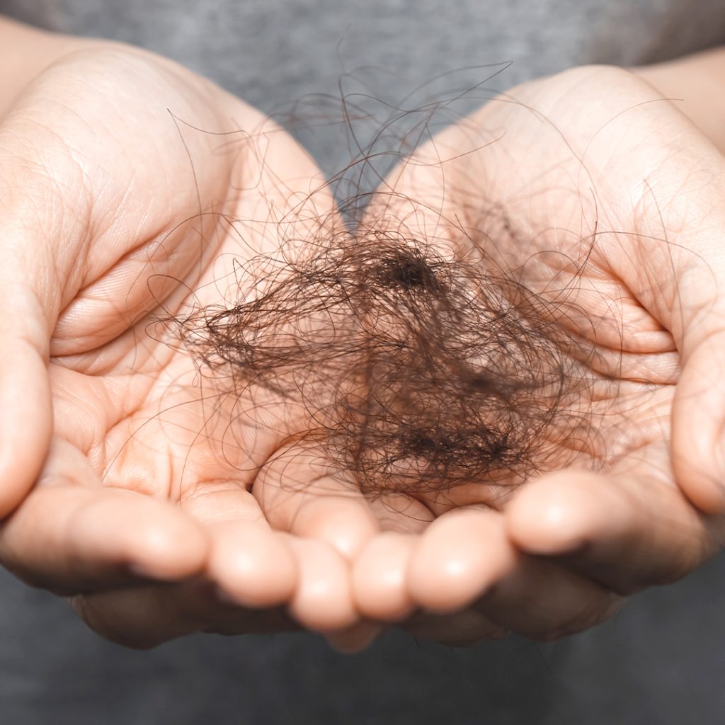 Caduta dei capelli stagionale uomo