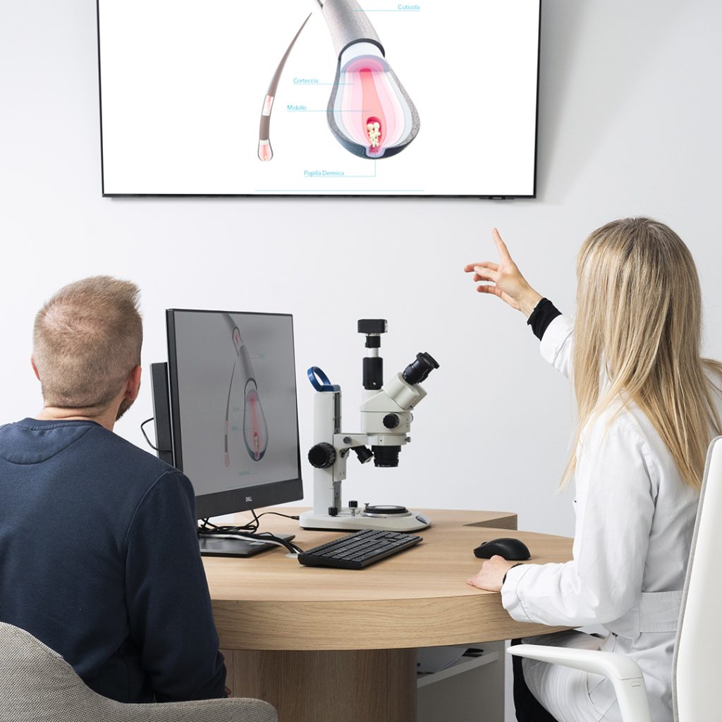 Il trapianto di capelli Smart Fue