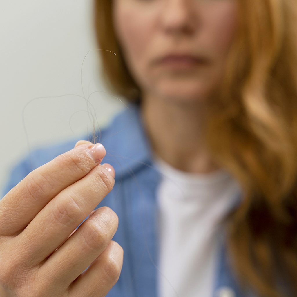 Perché cadono i capelli
