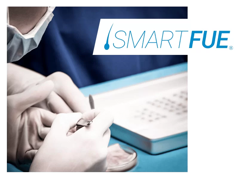 Caduta capelli menopausa soluzioni smart fue.png