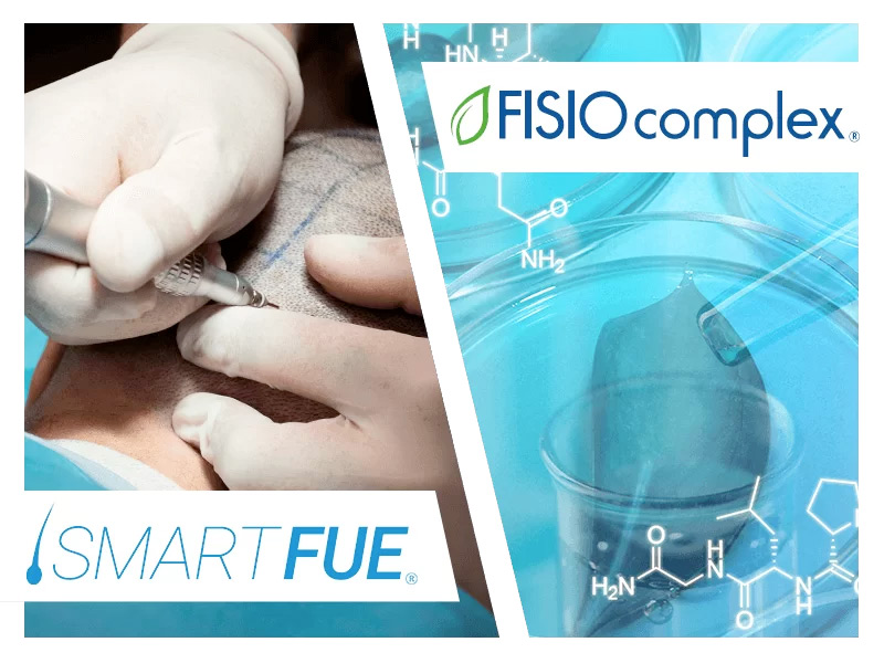 cause caduta capelli alopecia seborroica soluzioni smart fue fisio complex