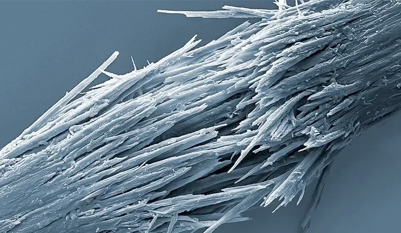 cause caduta capelli alopecia trazione capelli trattati chimicamente