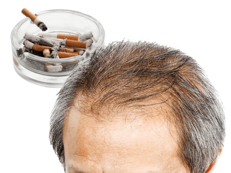 cause caduta capelli fumo