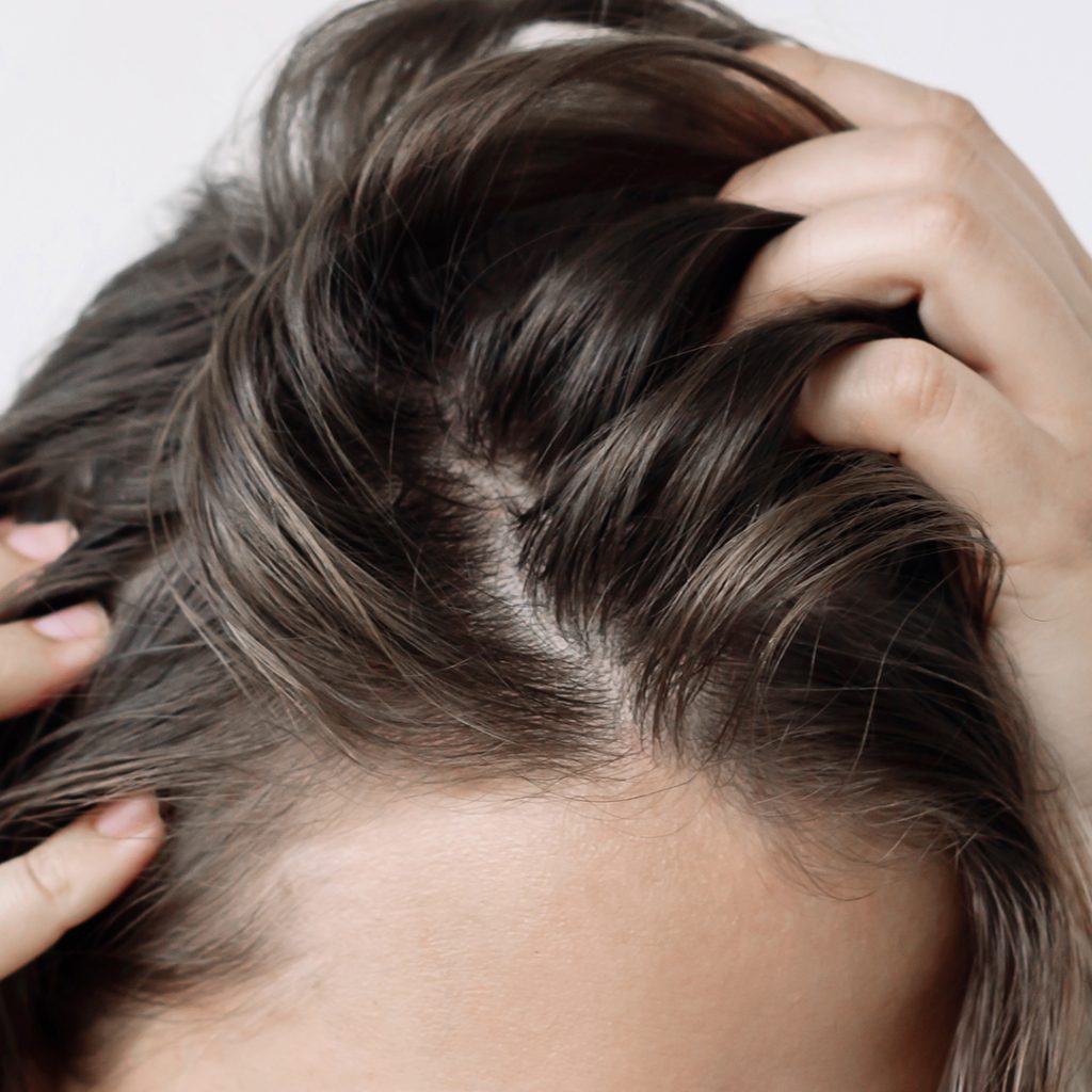 Problemi al cuoio capelluto