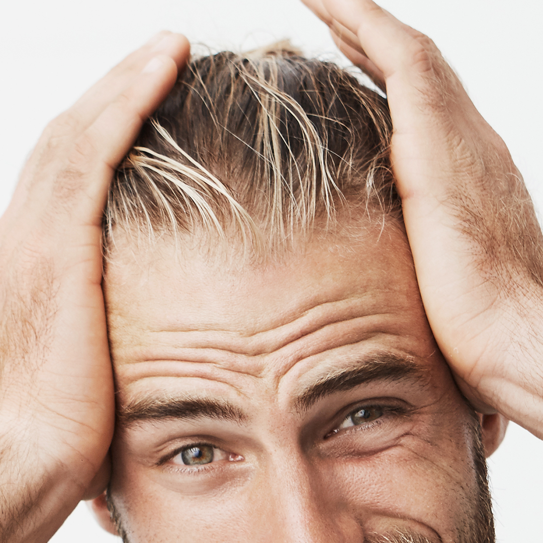 Problemi cuoio capelluto capelli rovinati