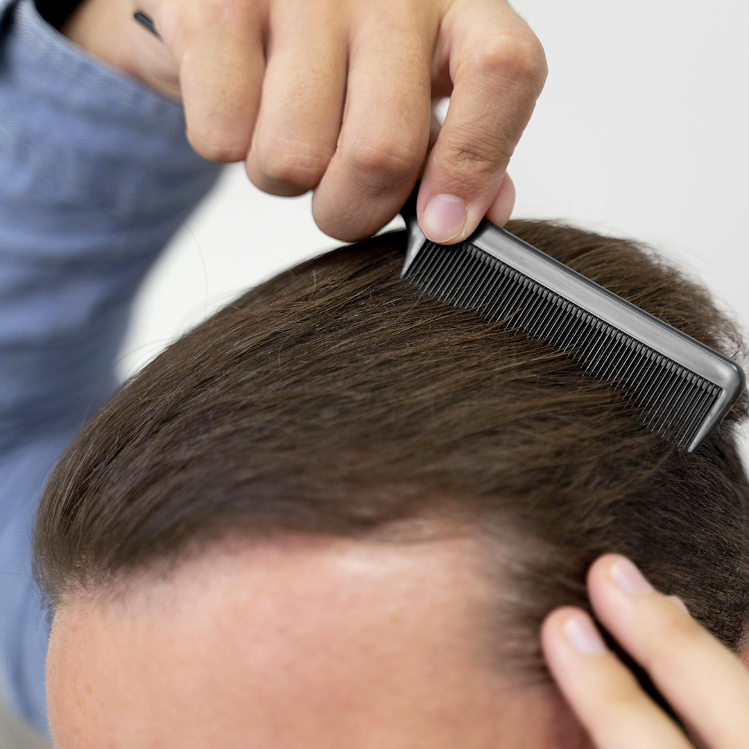 Problemi cuoio capelluto capelli secchi