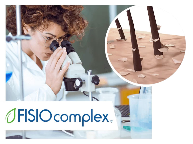 problemi cuoio capelluto forfora soluzioni fisio complex