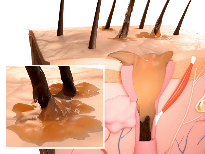 sudorazione cuoio capelluto