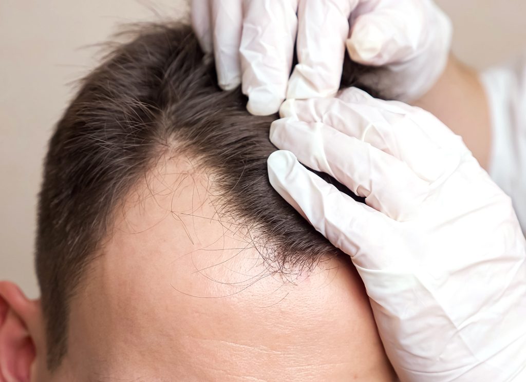 Il protocollo Smart Fue