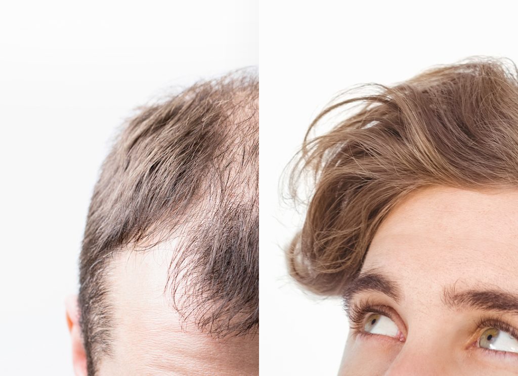 Risultati prima e dopo uomo