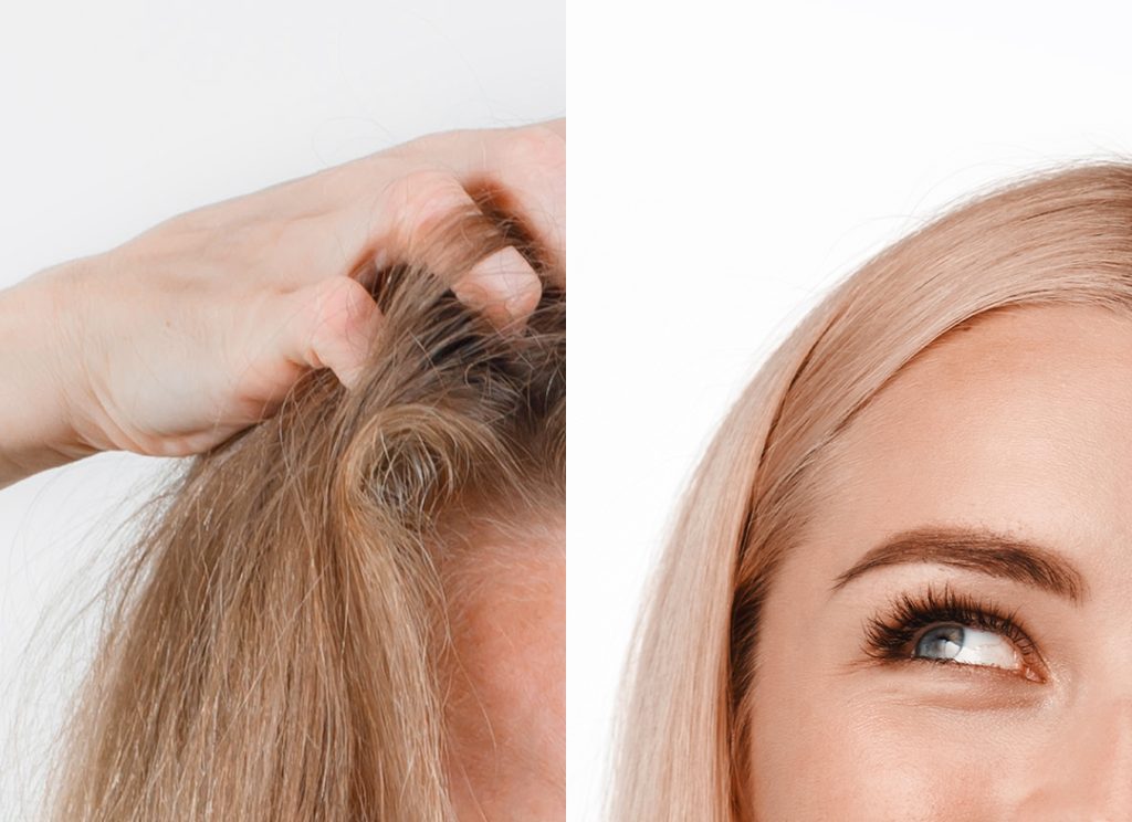 Risultati trapianto donna prima e dopo