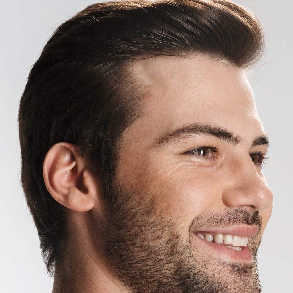 Soluzione cute secca