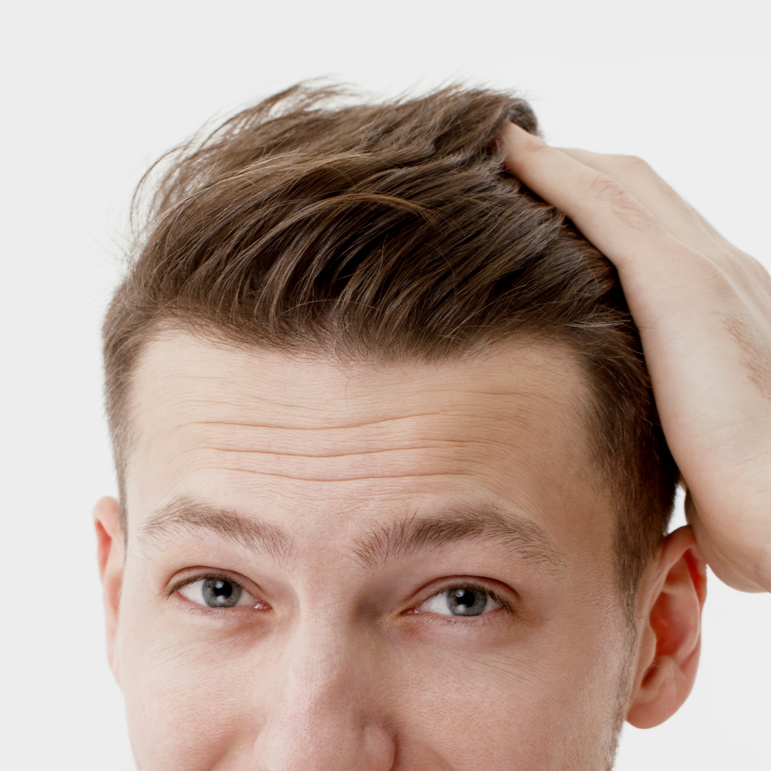 Risultati permanenti trapianto capelli