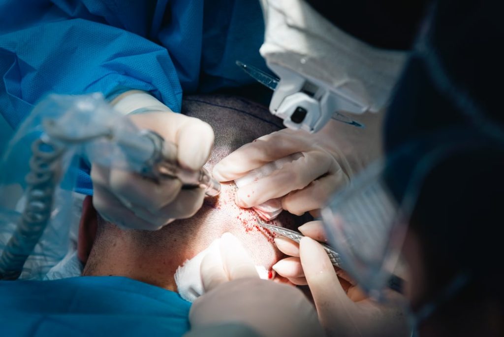 Soluzione alopecia da trazione