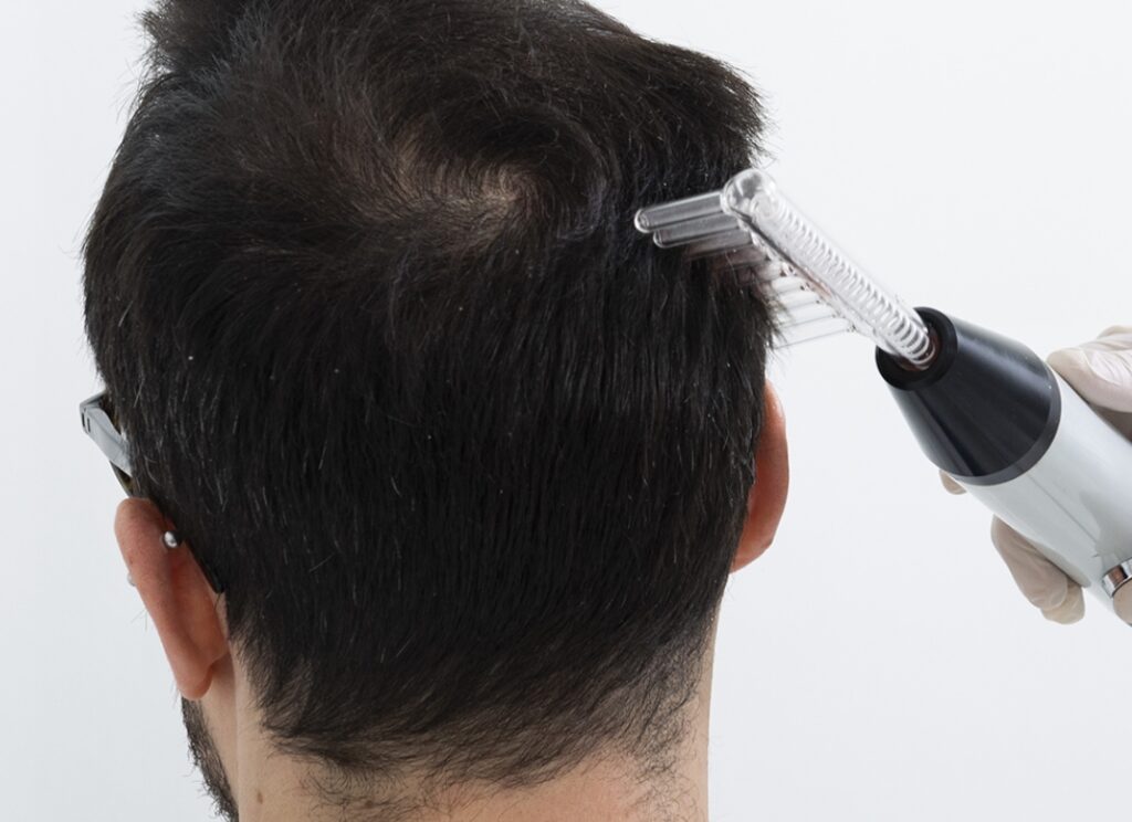 I trattamenti fisio complex