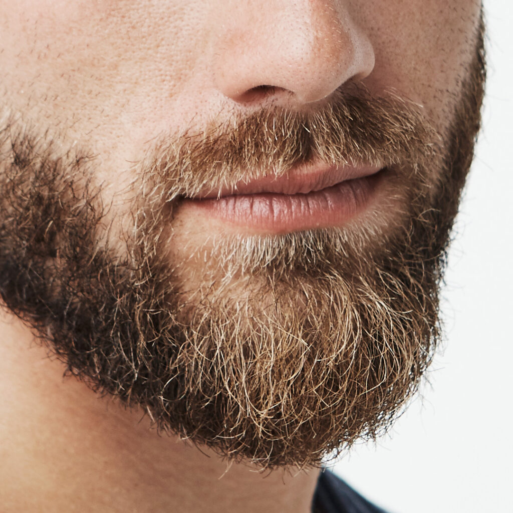 Come funziona il trapianto di barba?