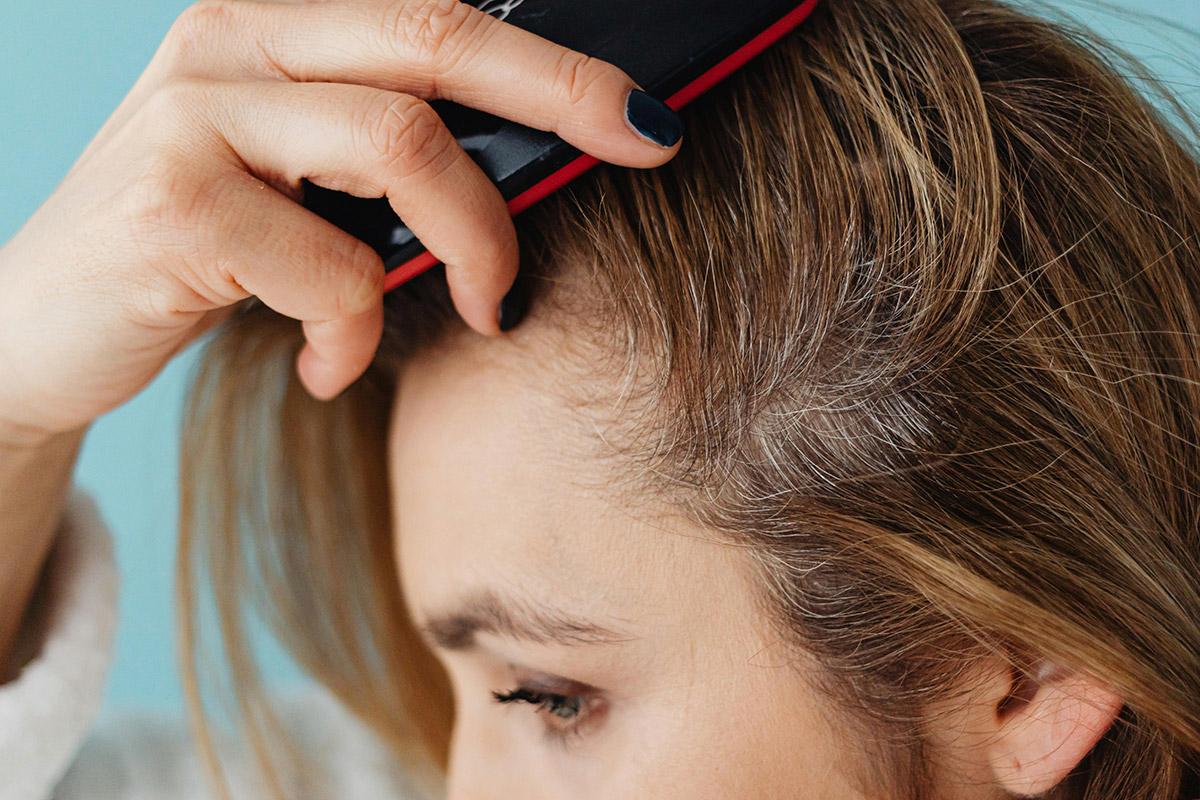 Gli integratori naturali per prevenire la caduta dei capelli